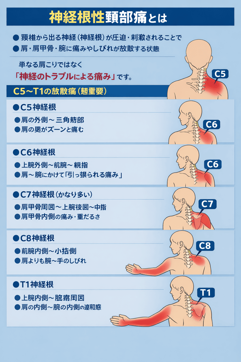 神経根性頚部痛