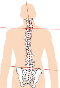 顔の歪みを整えるために見るべき全身バランス