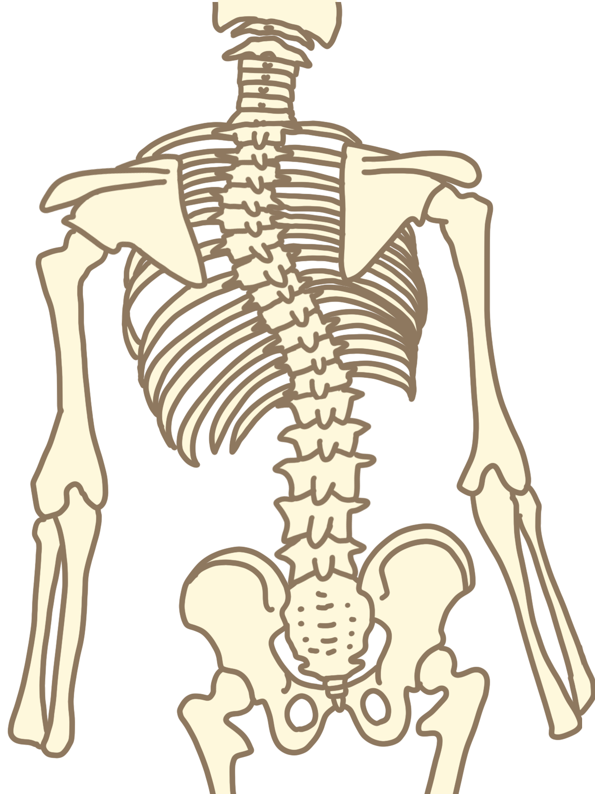 側弯症の特徴と見た目の変化