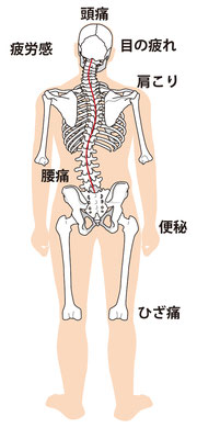 デスクワークでは、頭痛、首痛、肩こり、巻肩、猫背でバッグを同じ側で持つと、首痛、肩上がり、背骨の湾曲 ヒールを履くことが多いと、外反母趾、O脚、膝痛、腰痛