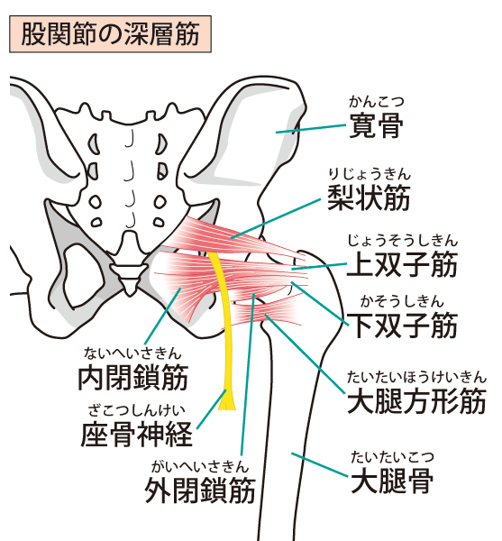 坐骨神経痛、お尻痛