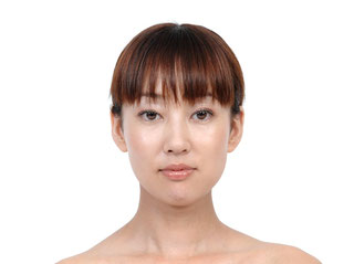 顔美人になった方のビフォーアフター体験