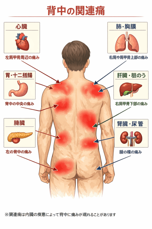 背中の関連痛の出方(代表パターン